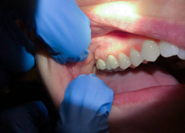 Best Broken Tooth Emergency  in Breese, IL