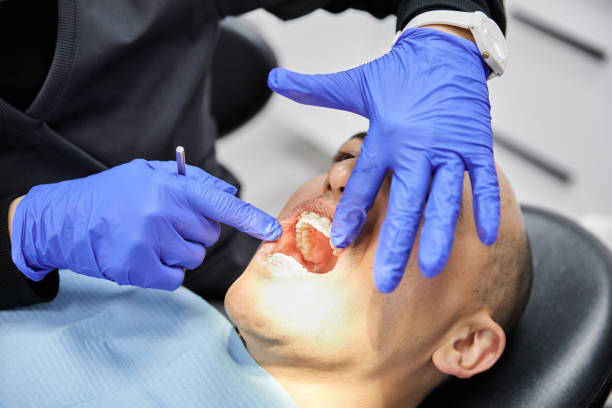 Best Emergency Dental Filling Replacement  in Breese, IL